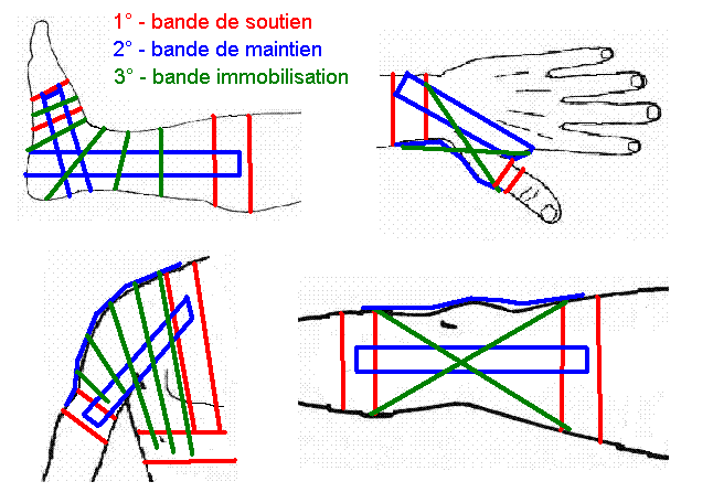 positions des straps